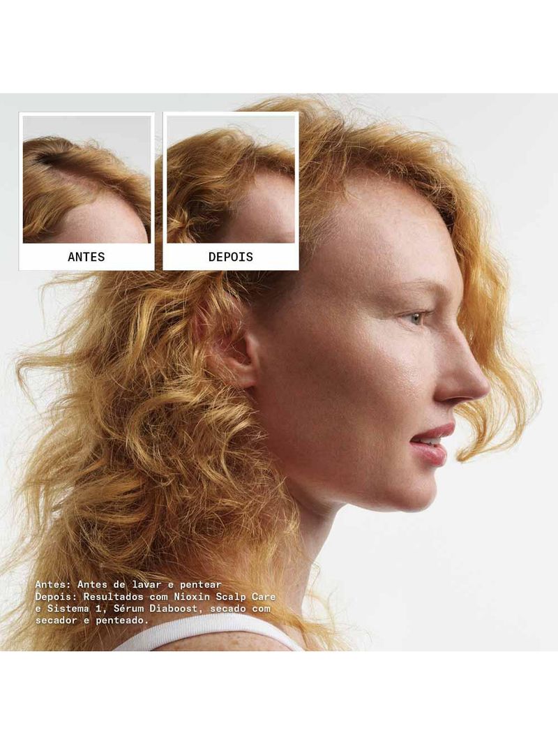 Nioxin system 1 kit - shampoo + condicionador + tratamento