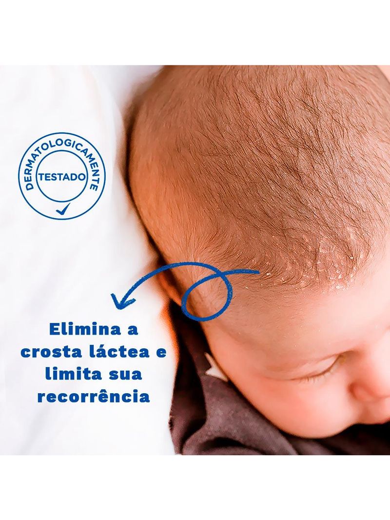 Creme infantil mustela bebê stelaker crosta láctea