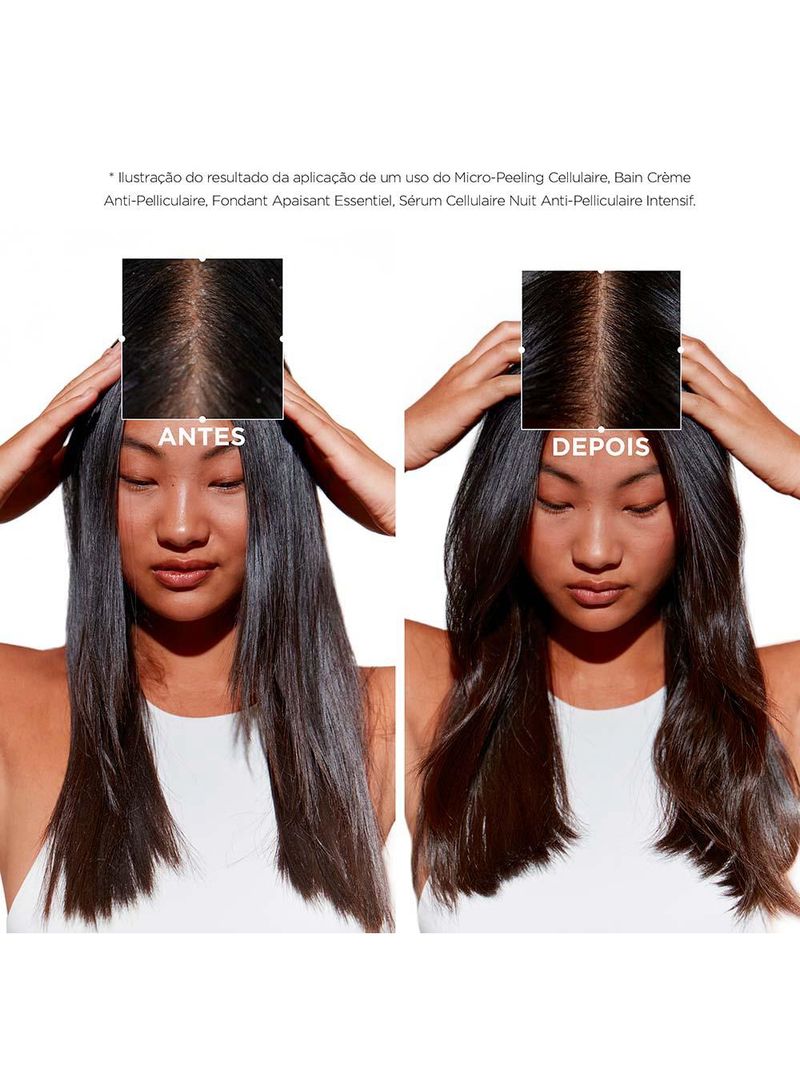 Kérastase symbiose anti-pelliculaire intensif sérum noturno