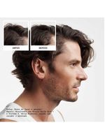 Nioxin system 2 kit - shampoo + condicionador + tratamento