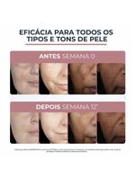 Sérum facial eucerin anti-pigment clareador - dual sérum