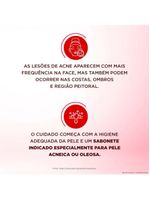 Sabonete líquido facial para pele muito oleosa e acneica dermotivin salix