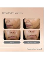 Sérum facial clareador isdin - melaclear advanced
