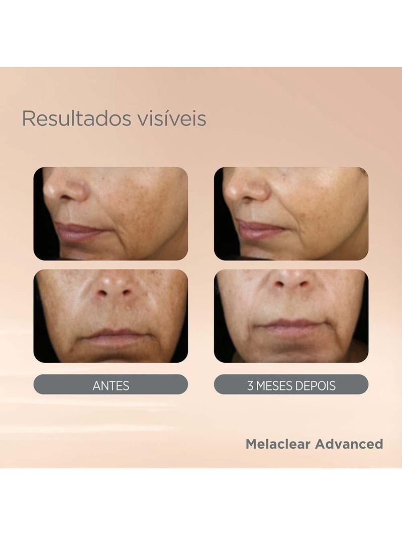 Sérum facial clareador isdin - melaclear advanced