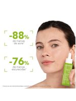 Sérum facial anti-idade concentrado anti-marcas da acne bioderma sébium sérum