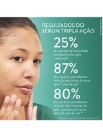 Sérum facial tripla ação cetaphil - oil control