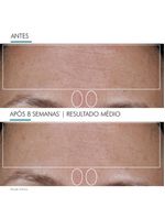 Sérum facial skinceuticals - cell cycle catalyst