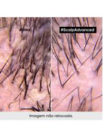 L'oréal professionnel scalp dermo clarifier shampoo anticaspa