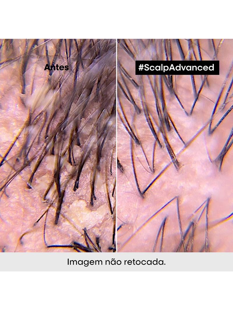 L'oréal professionnel scalp dermo clarifier shampoo anticaspa