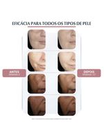 Creme facial eucerin anti-pigment noite