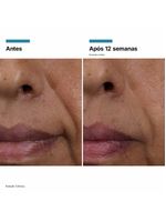 Sérum facial skinceuticals ha intensifier multi-glycan