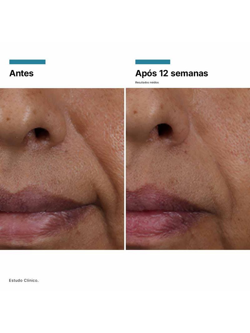 Sérum facial skinceuticals ha intensifier multi-glycan