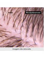 L'oréal professionnel scalp argila purificante