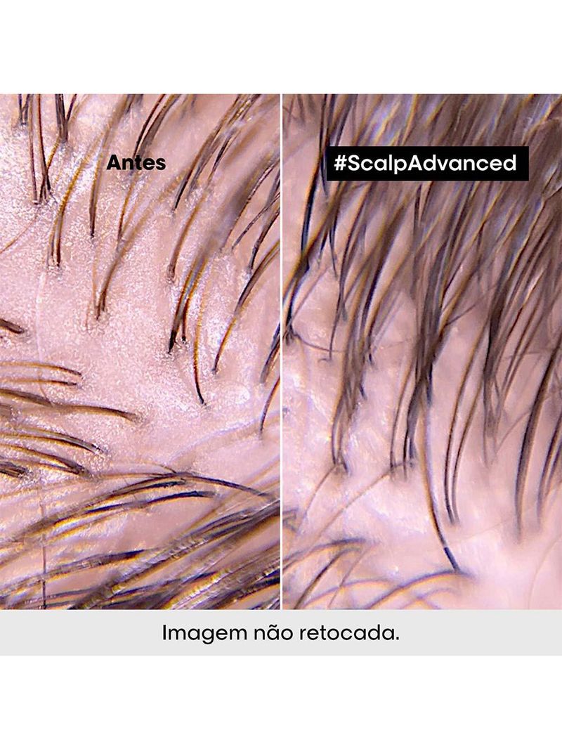 L'oréal professionnel scalp argila purificante