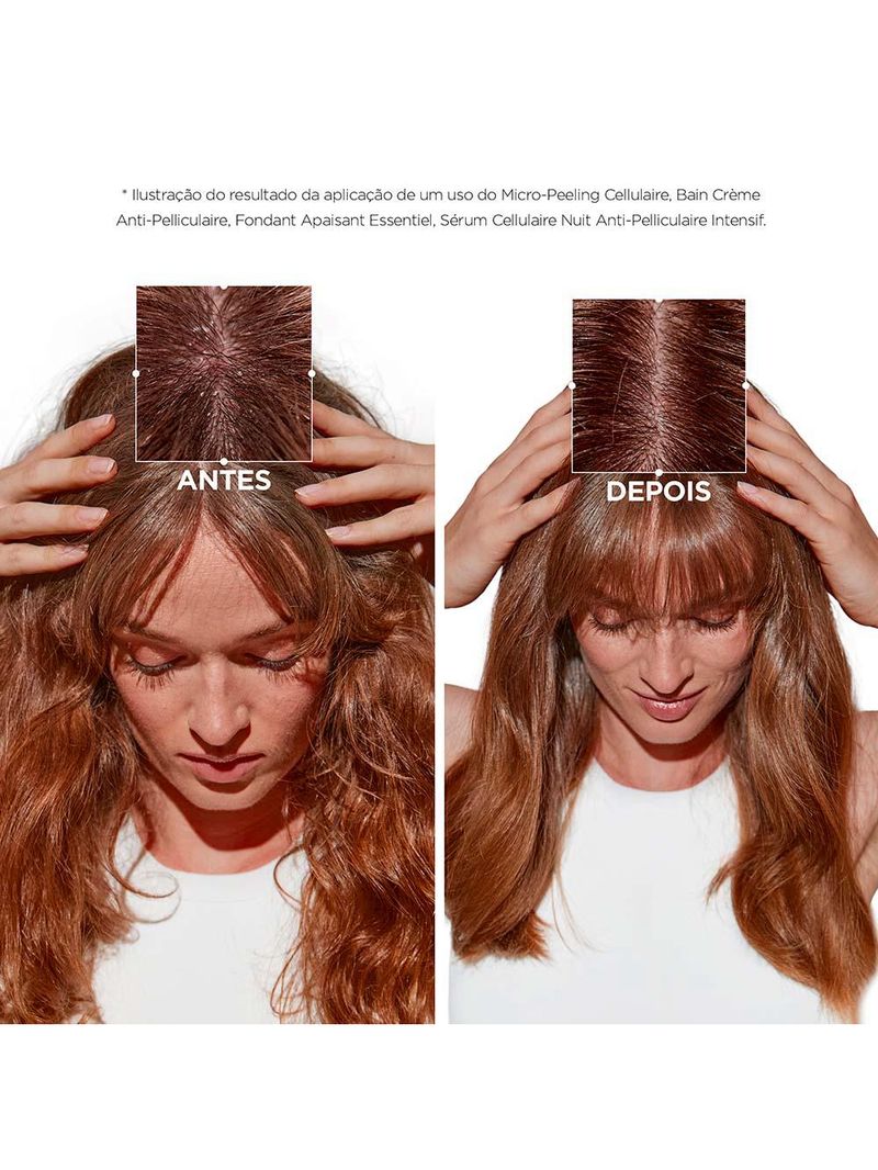 Kérastase symbiose micropeeling tratamento esfoliante