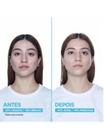 Sérum facial garnier uniform & matte antiacne