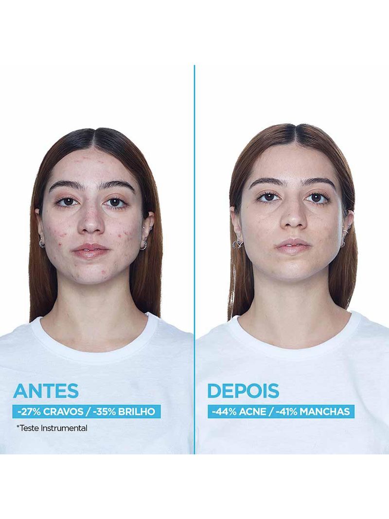 Sérum facial garnier uniform & matte antiacne