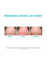 Gel hidratante para os pés isdin - ureadin podos