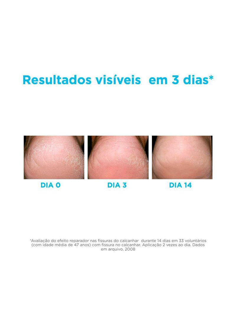 Gel hidratante para os pés isdin - ureadin podos
