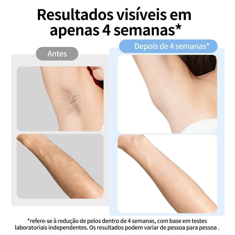 Depilador a Laser Ipl Ulike Me Luz Pulsada Indolor para Corpo e Rosto com Safira Bivolt
